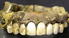 دندان‌های قربانیان جوان جنگ‌ها به پروتز دندان مصنوعی تبدیل میشدند!