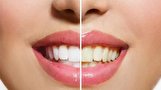 ترفند‌هایی جالب برای محافظت از دندان‌ها در برابر زردی