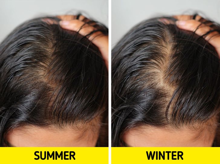۶ اتفاقی که می‌تواند در زمستان برای مو‌های شما بیفتد و چگونگی رفع آنها!