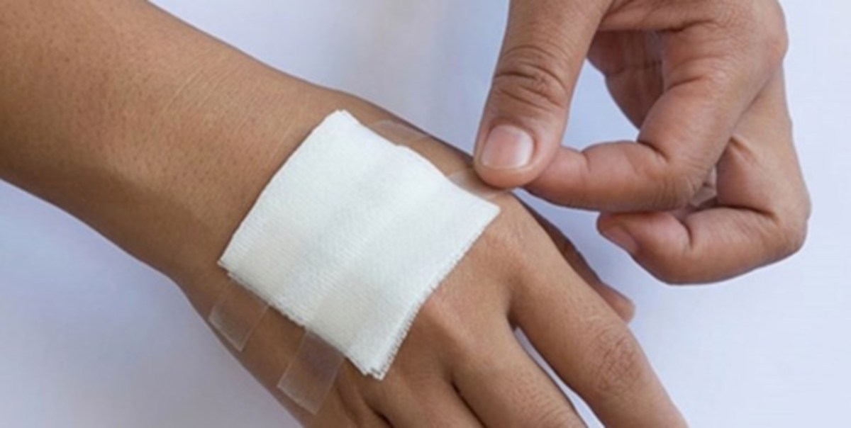 ایران سومین تولیدکننده پانسمان‌های نانو کریستال نقره در جهان / کنترل عفونت با محصولی دانش بنیان