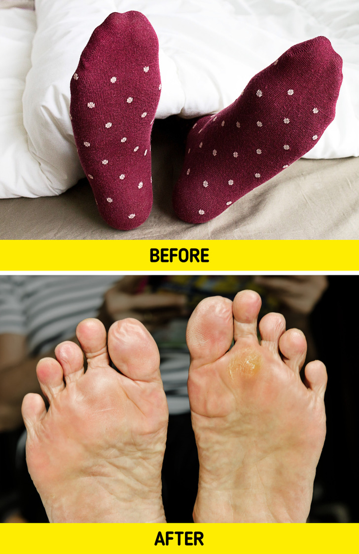 اگر هنگام خواب جوراب بپوشید چه اتفاقی می‌افتد؟