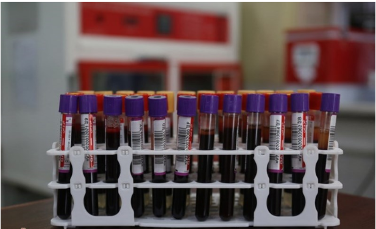 رشد ۶ درصدی شاخص اهدای خون در سال ۱۴۰۰/ شرایط اهدای خون چیست؟