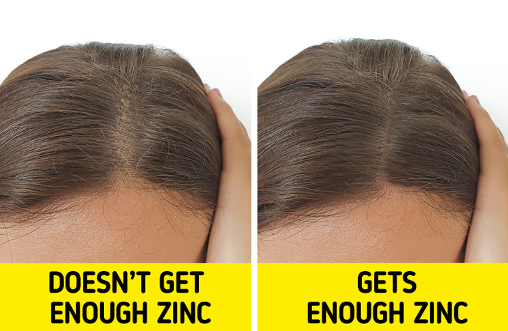 ۷ نکته برای تقویت و محکم‌تر کردن موهایتان