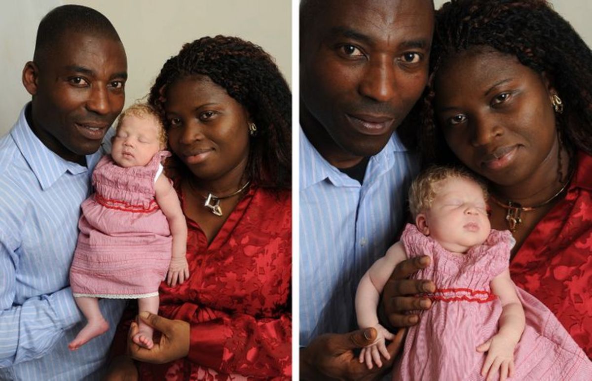 چرا برخی از زوج‌ها از نظر ژنتیکی دارای فرزندانی با رنگ پوست متفاوت هستند