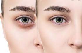 ۶ شگفتانه توت‌ فرنگی برای پوست