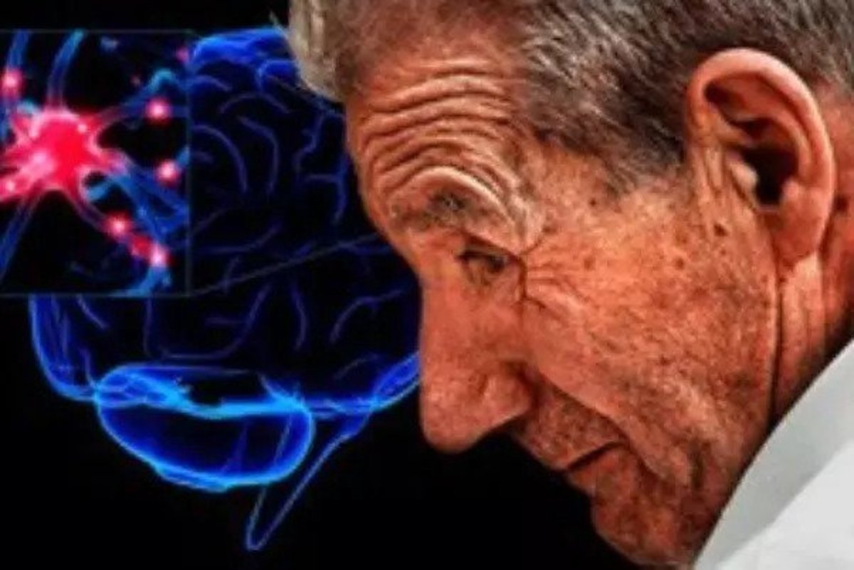 عوامل موثر برای مهار بیماری پارکینسون بررسی شد