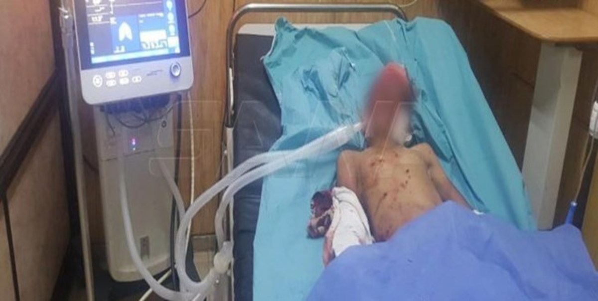 انفجار در سوریه به کشته شدن ۲ غیرنظامی و زخمی شدن ۶ کودک منجر شد