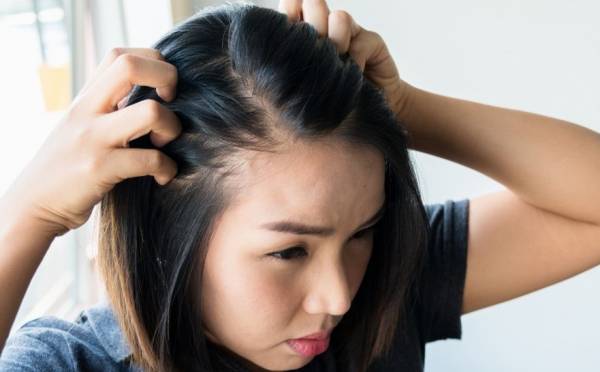 علل و راه درمان ریزش مو