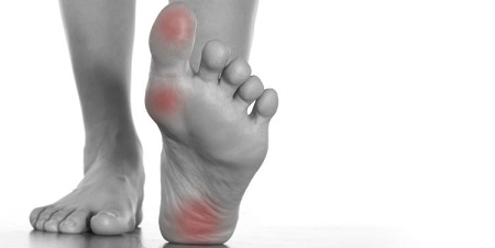 عوامل ایجاد درد پاشنه پا هنگام پیاده روی و دویدن و راهکار های درمان آن