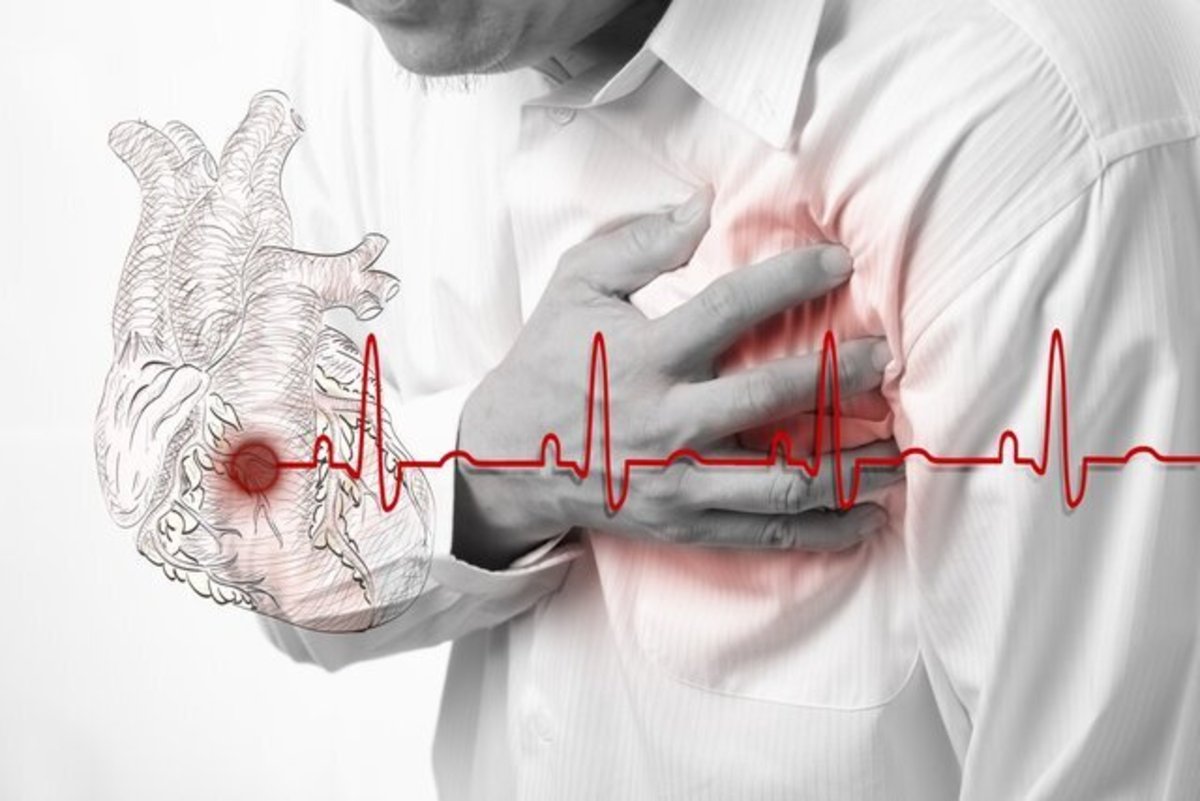 آنچه از سکته قلبی نمی‌دانید