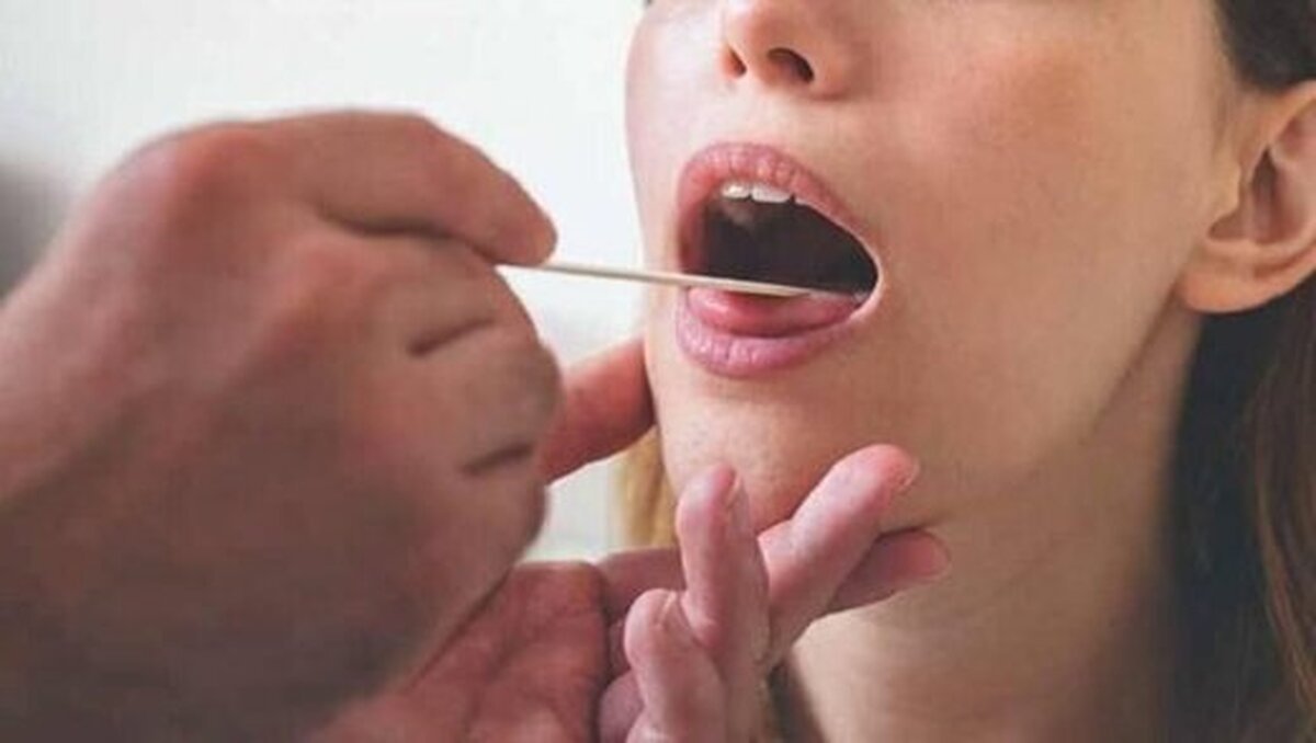 این علامت خاص در زبان نشانه سرطان است