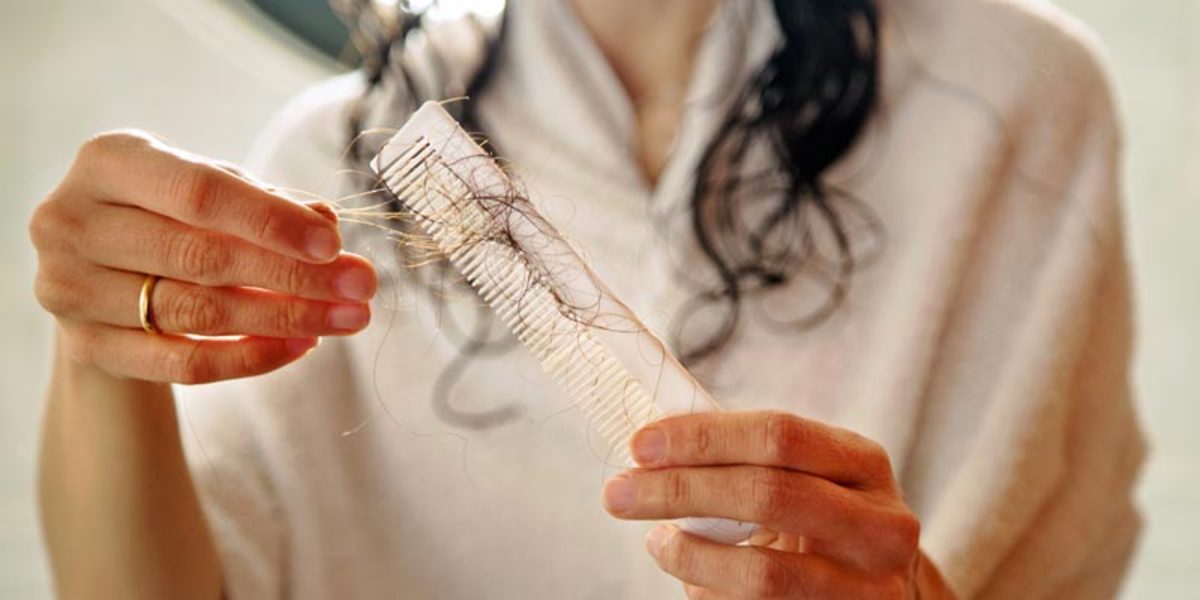 استرس و رژیم لاغری علت اصلی ریزش شدید مو در بانوان