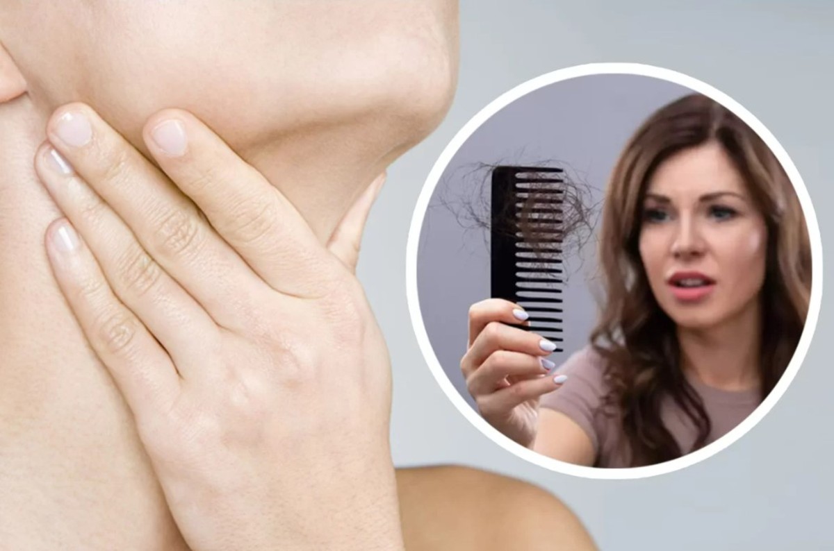 آیا کم کاری و پرکاری تیروئید باعث ریزش مو می‌شود؟