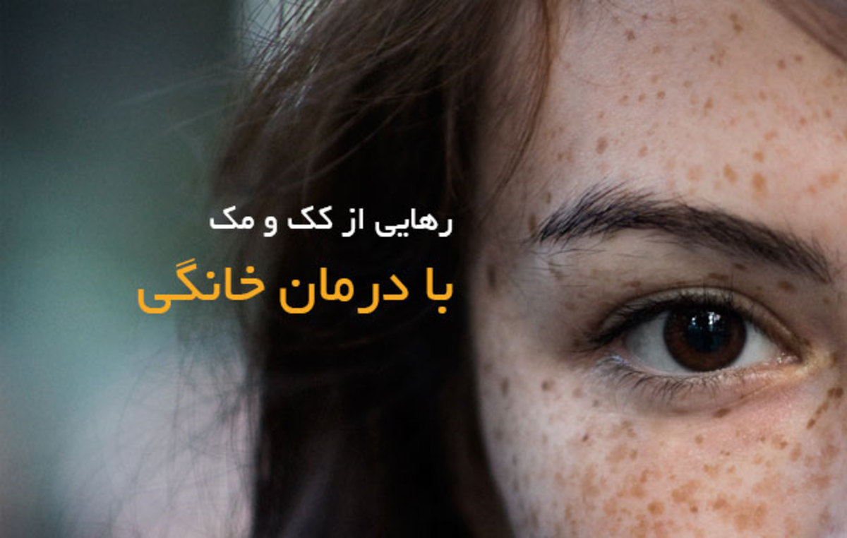 با این روش‌ها با کمترین هزینه در خانه از شر کک و مک خلاص شوید