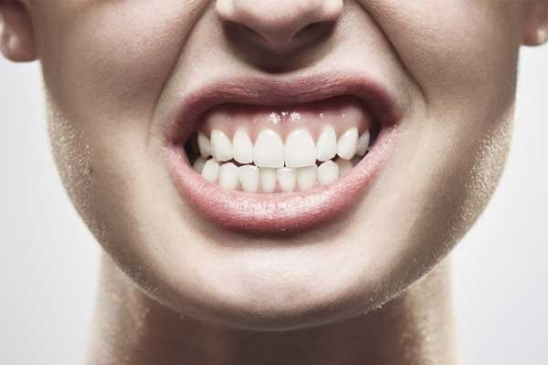 ۵ نشانه‌ای که می‌گوید شما دچار دندان قروچه شبانه هستید