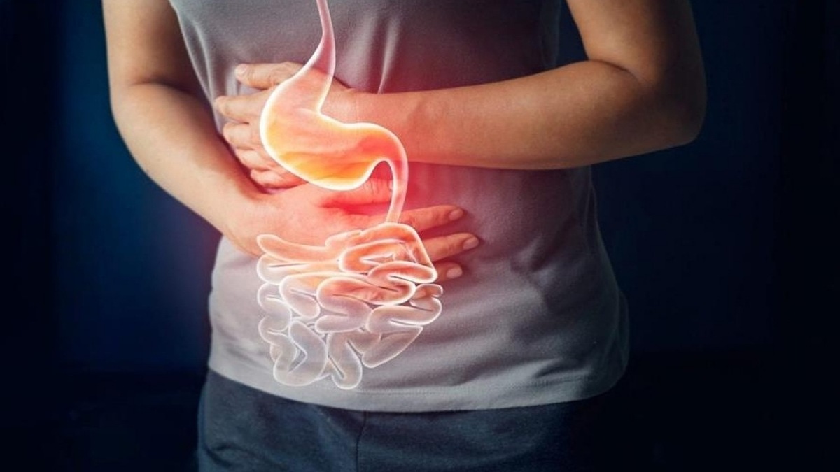 درمان زخم معده با طب سنتی