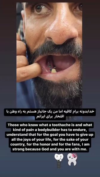 دندان‌های عجیب گرگ ایرانی؛ چوپان دنبال کنندگانش را شوکه کرد + عکس