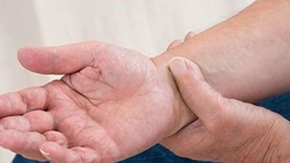 نشانه‌های اختلال عصبی پارکینسون
