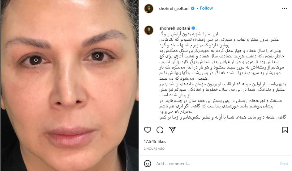 شهره سلطانی: این منم! شهره بدون آرایش و رنگ و بینی عمل کرده