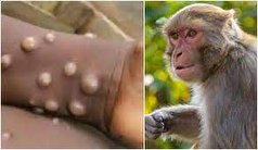 مهم‌ترین علت انتقال «آبله میمونی»