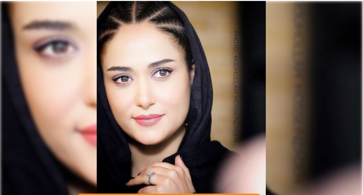 چهره نچرال پریناز ایزدیار به همراه مهمان ناخوانده اش