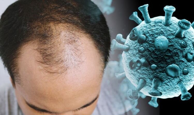 ماجرای درمان ریزش مو ناشی از کرونا با پاستیل‌های میلیونی!