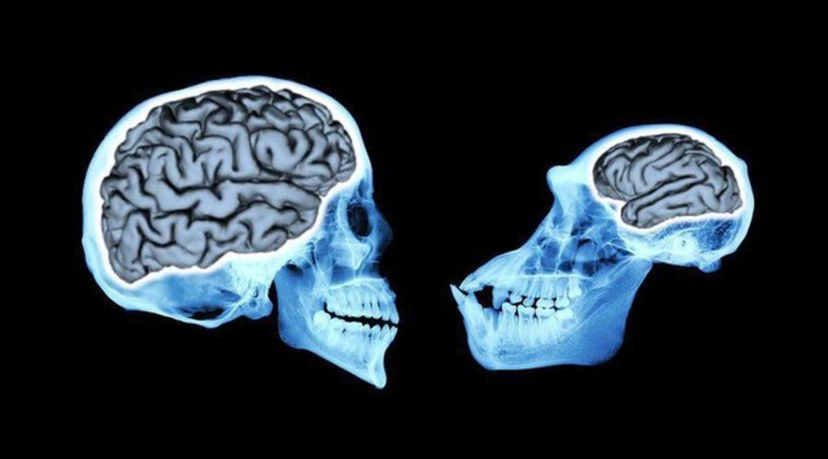 کوچک شدن مغز انسان در ۳ هزار سال پیش؟!