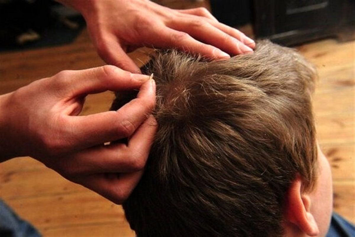 افزایش احتمال ابتلا دانش آموزان به شپش سر با شروع سال تحصیلی جدید