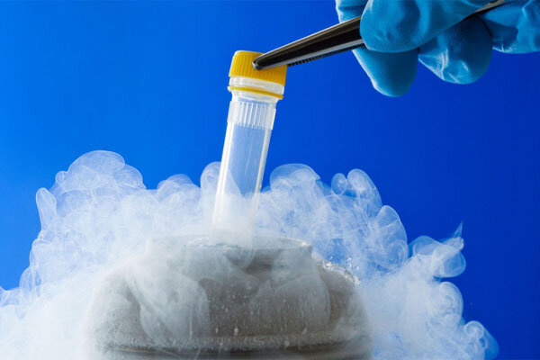 فریز تخمک بانوان به چه روشی انجام میشود؟
