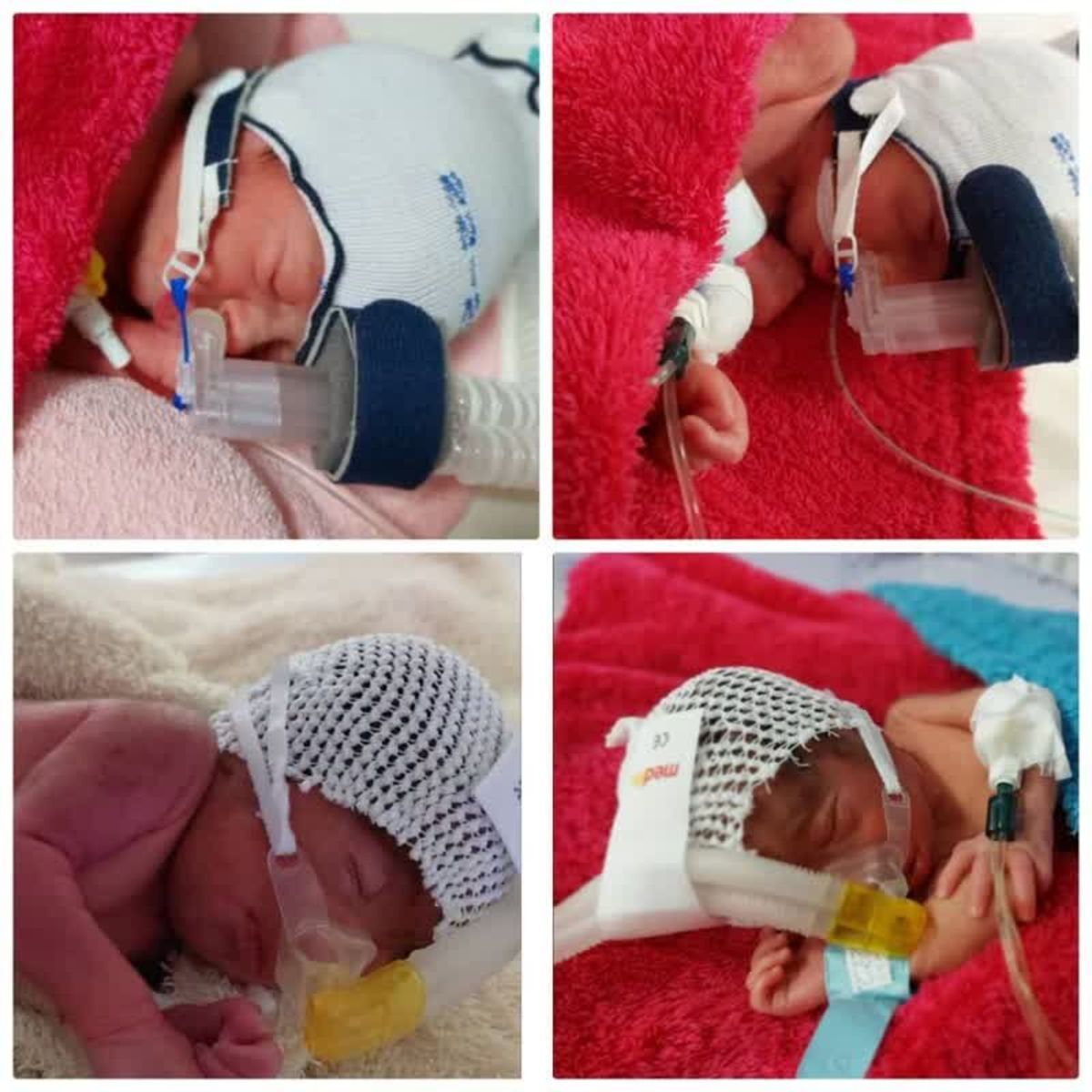 چهار قلو پس از ۱۰ سال نازایی؛ ۲ دختر و ۲ پسر مادری ۳۲ ساله