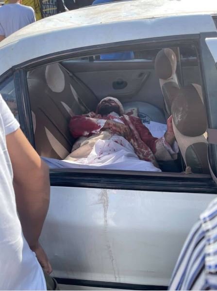 جزئیات حمله به طلبه روحانی در کرج توسط اغتشاشگران