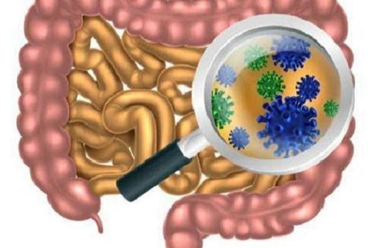 اختلال در میکروبیوم‌های روده در اثر عفونت کووید ۱۹