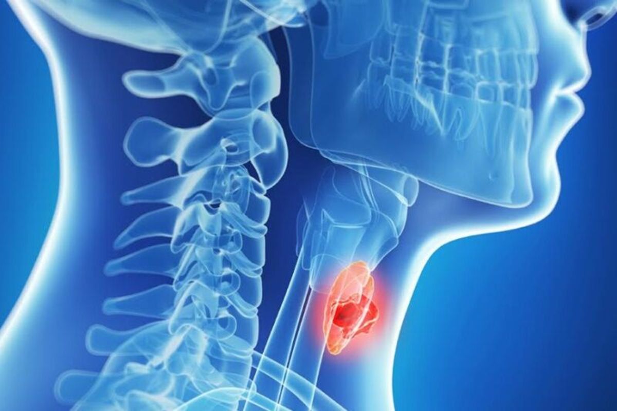 کنترل کم‌کاری تیروئید با یک تست ساده خون و دارو درمانی