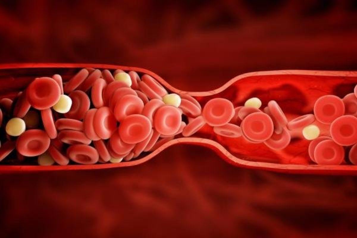 چرا دچار نارسایی مزمن قلبی می‌شویم؟