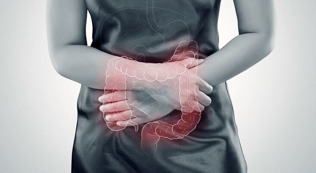 با این ۶ راهکار سلامت روده خود را تضمین کنید