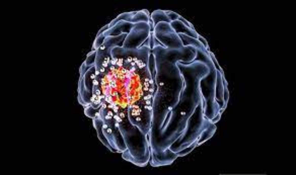 هدایت دارو به سمت تومور‌ها با روشی نوین