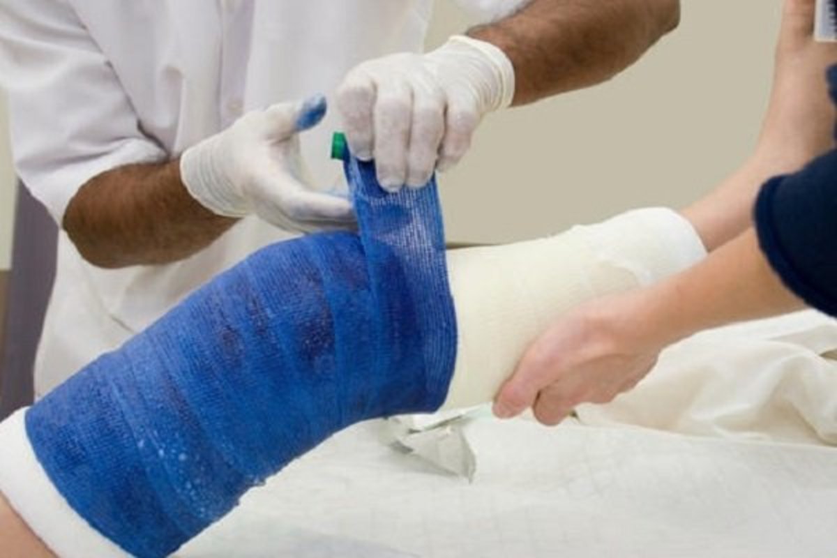 نحوه رفتار با فرد قطع عضو شده چگونه است؟