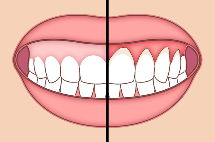توصیه‌هایی طلایی برای مراقبت از دهان و دندان