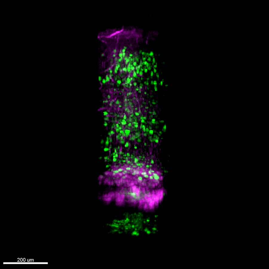دیدن اعماق مغز موش با میکروسکوپی مینیاتوری