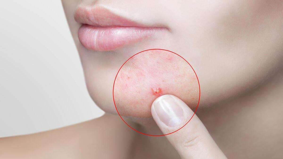 بررسی وضعیت پوست در مراحل مختلف قاعدگی