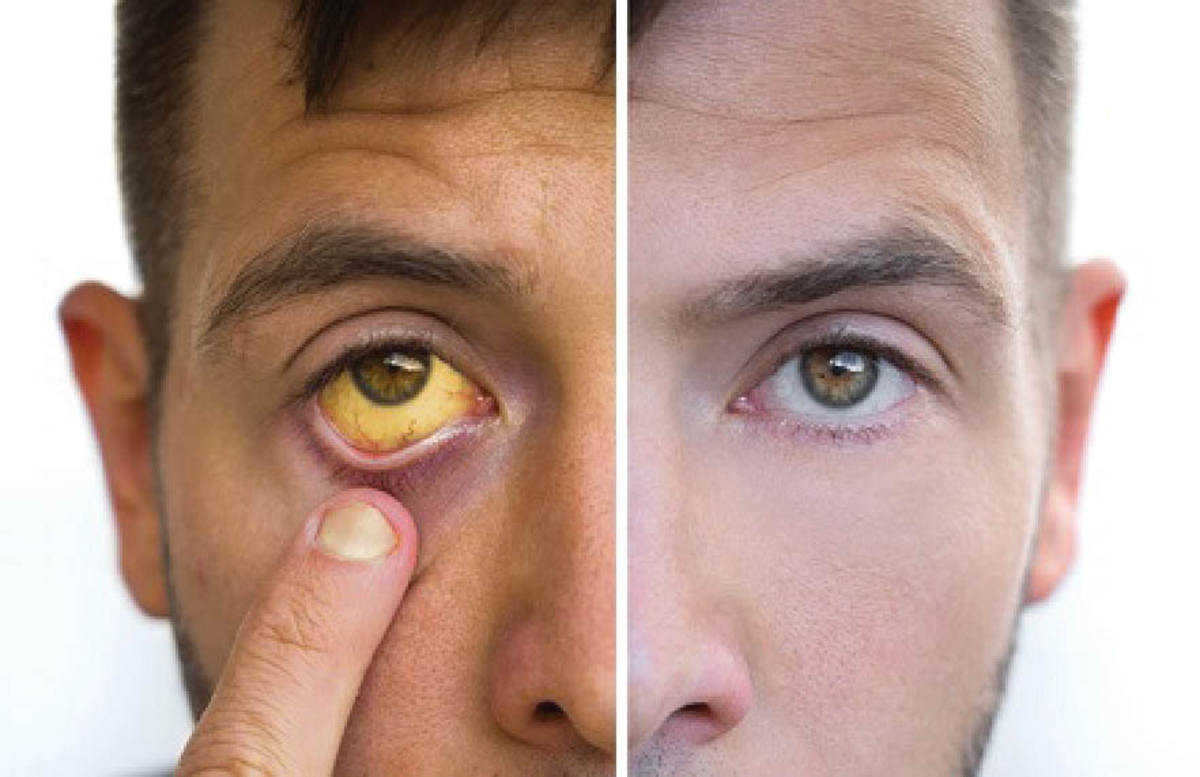 وقتی تغییرات صورت خبر از بیماری‌ها می‌دهد