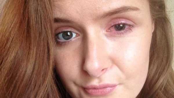 هنگام استفاده از لنز چشم این نکات حیاتی را فراموش نکنید