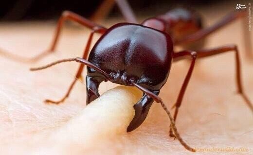 شکار صحنه گاز گرفته شدن انسان توسط مورچه با دوربین‌های فوق حرفه‌ای