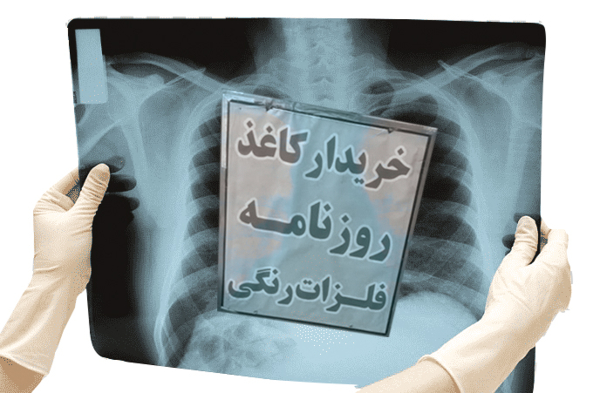از عکس رادیولوژی می‌توانیم نقره بدست بیاوریم؟