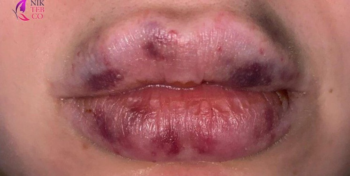 روی دیگر ویروسی به نام «زیبایی پوشالی»