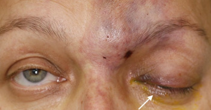 روی دیگر ویروسی به نام «زیبایی پوشالی» روی دیگر ویروسی به نام «زیبایی پوشالی»