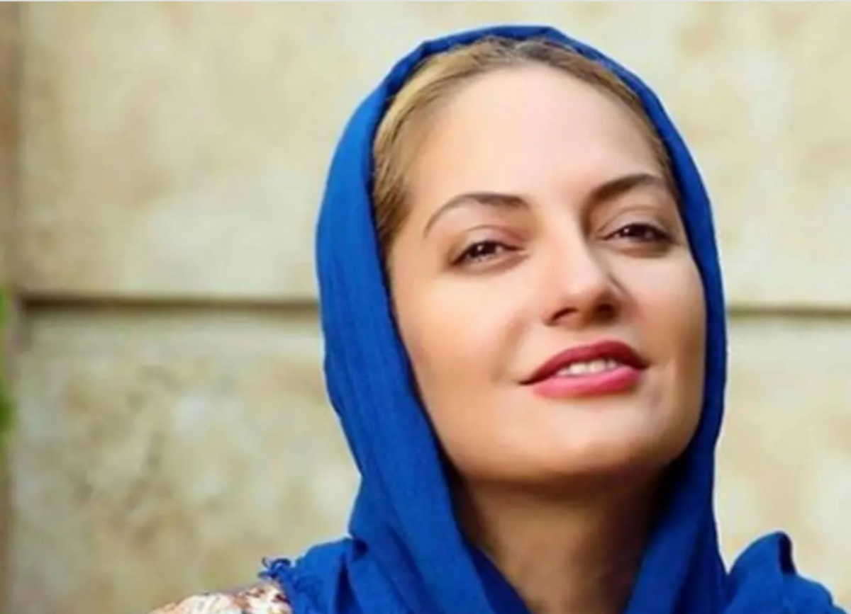 صورت ترکیده مهناز افشار همه را شوکه کرد/ببینید