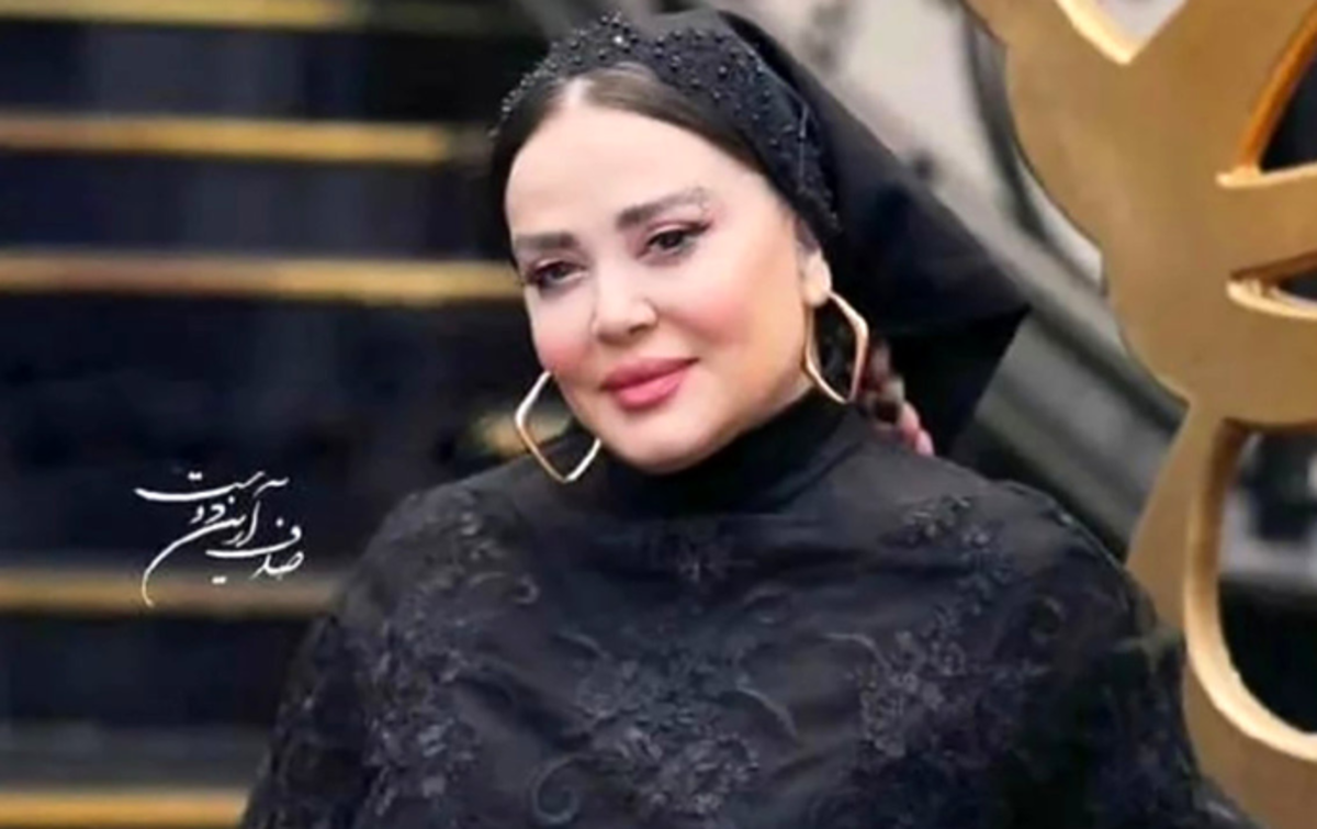 شکایت خانم بازیگر از دکتر زیبایی اش غوغا به پا کرد/ماجرا چیست؟