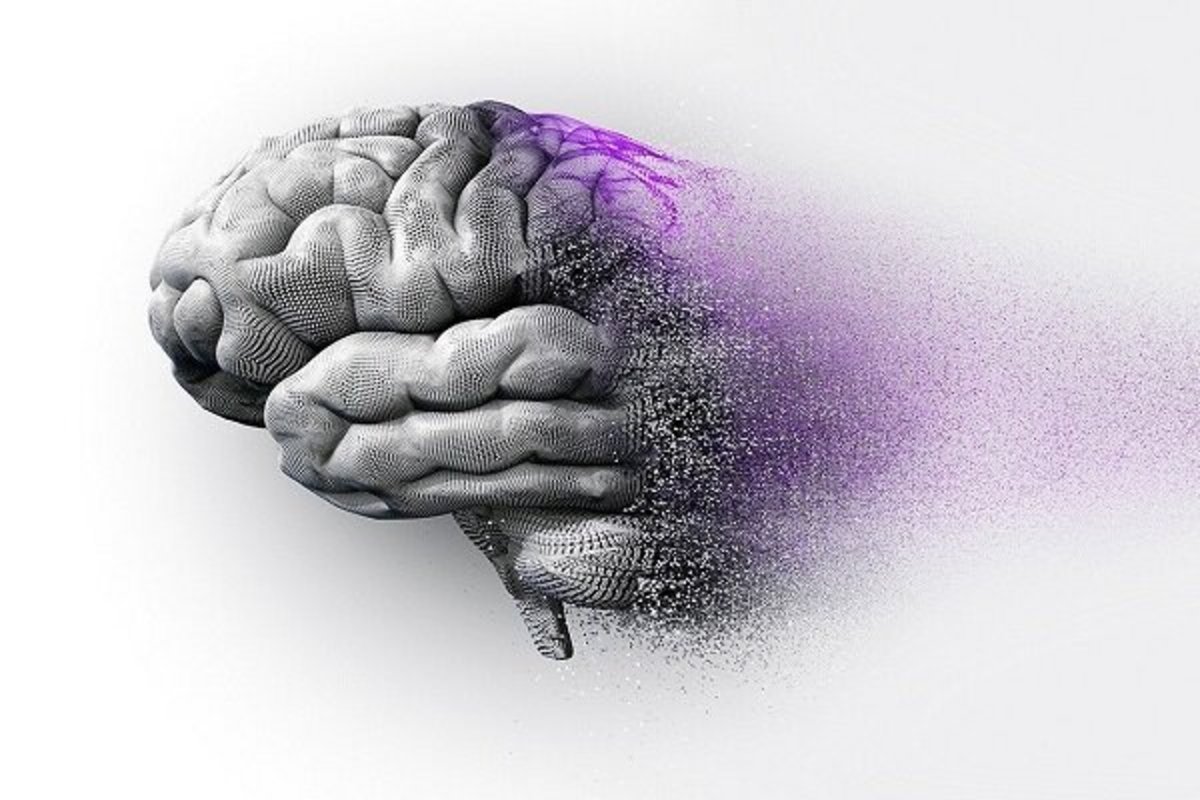 پنج مورد از رایج‌ترین علائم زوال عقل