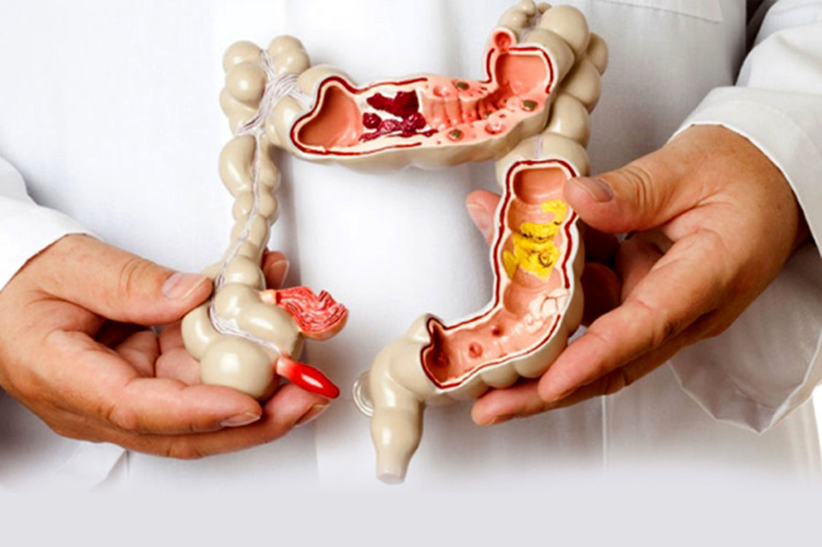 سندرم روده تحریک‌پذیر چه دردی ایجاد میکند؟